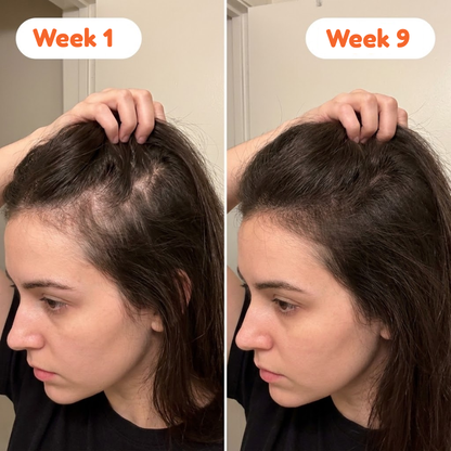 Nurevive Korean Hair Growth Serum