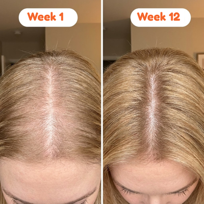 Nurevive Korean Hair Growth Serum