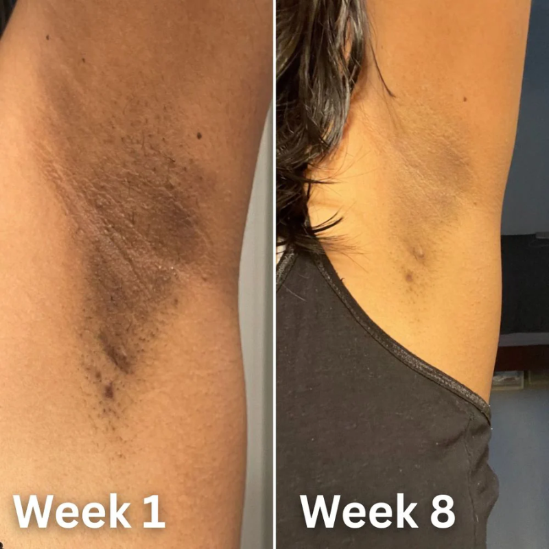 K-Glow ToneCare™ Deodorant