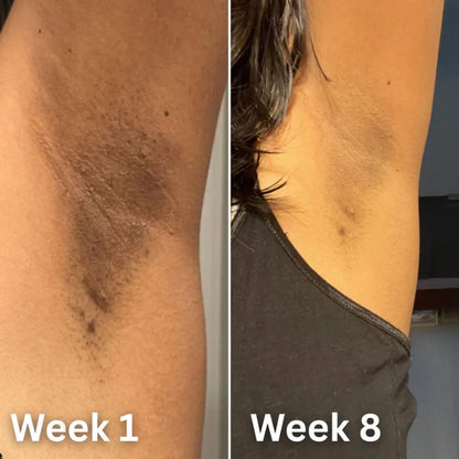Kojic Acid & Turmeric Deodorant