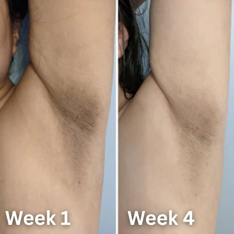 K-Glow ToneCare™ Deodorant
