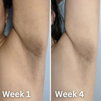 Kojic Acid & Turmeric Deodorant