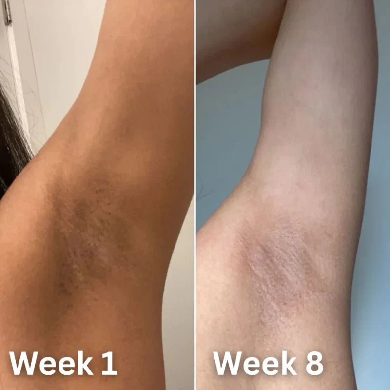 Kojic Acid & Turmeric Deodorant