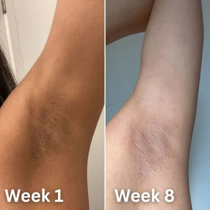 Kojic Acid & Turmeric Deodorant